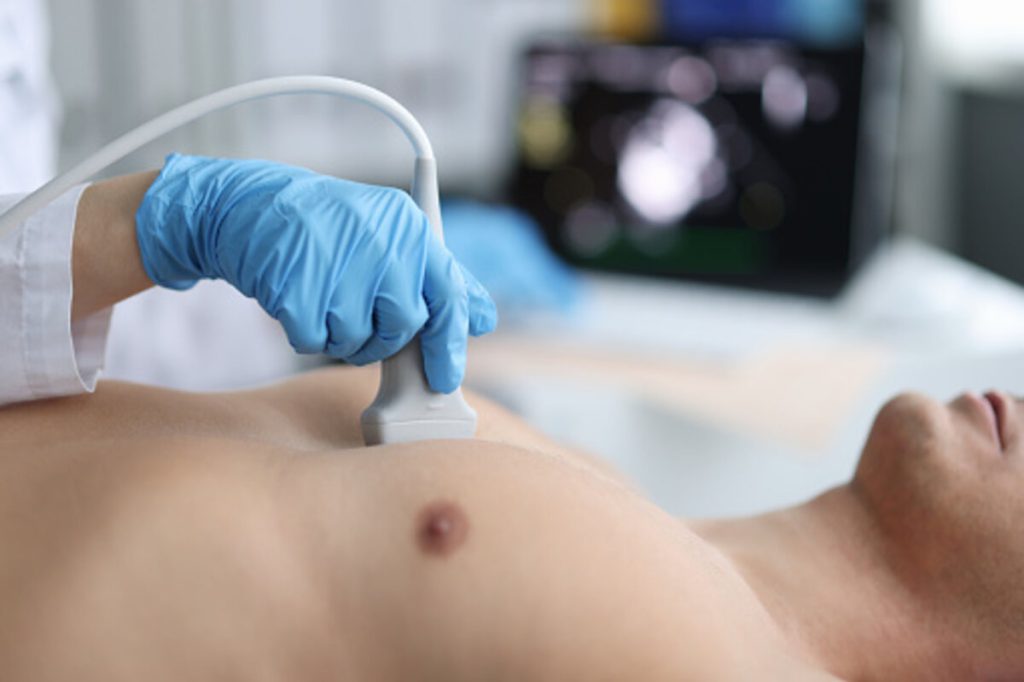 Cardiomyopathy – Diagnosis and Treatment