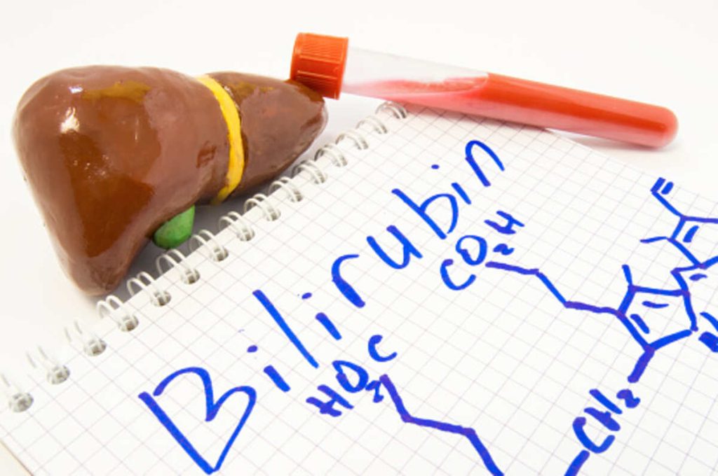 What is Bilirubin?
