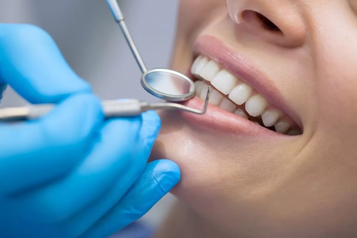 Need Pearly Whites? What to Expect From a Dental Cleaning