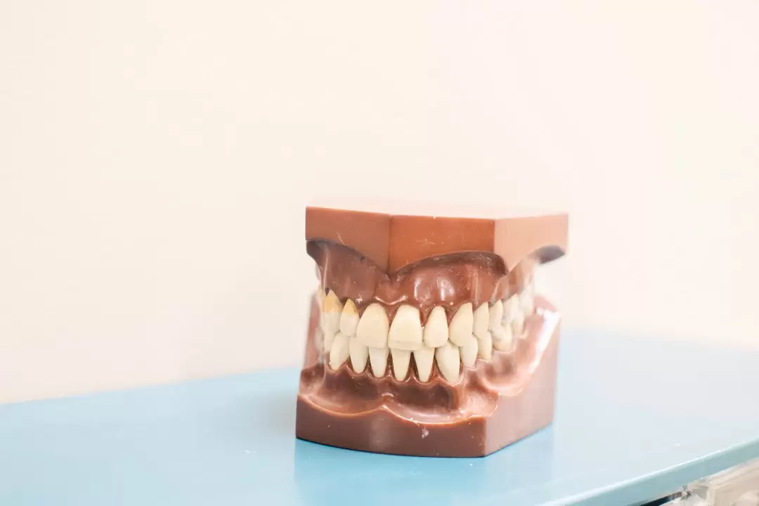 Tooth Alignment: Advantages of an Orthodontist vs. DIY Kits
