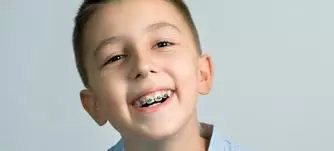 How Much Do Braces for Kids Cost? A Closer Look