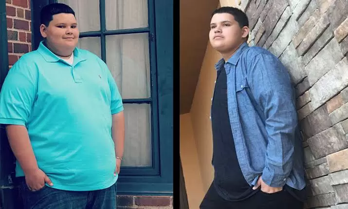 7 Pros and Cons of Weight Loss Surgery