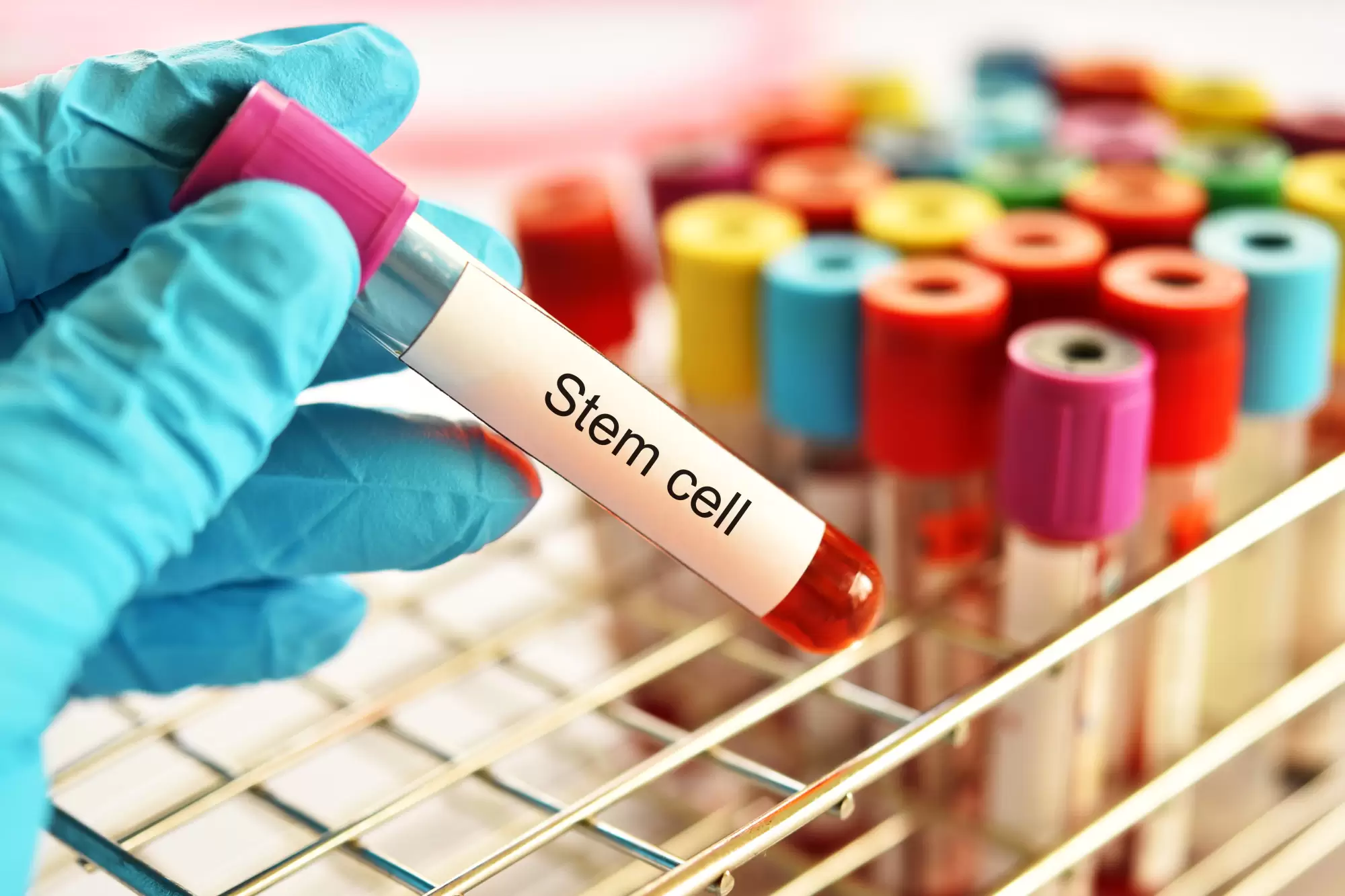 The Ultimate Guide to Self Healing Using Stem Cell Therapy