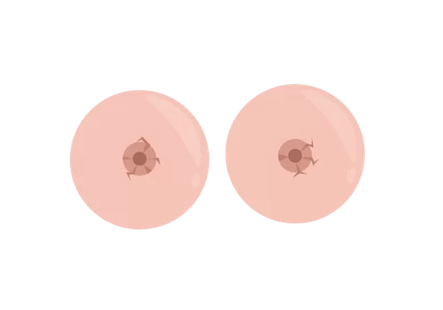 When to Worry About Swollen Breasts: A Healthcare Guide