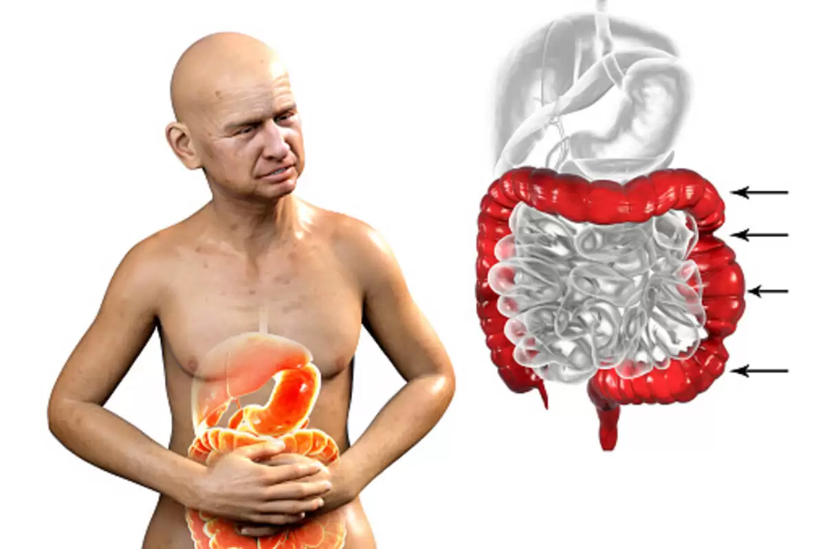 Serotonin Syndrome Drugs