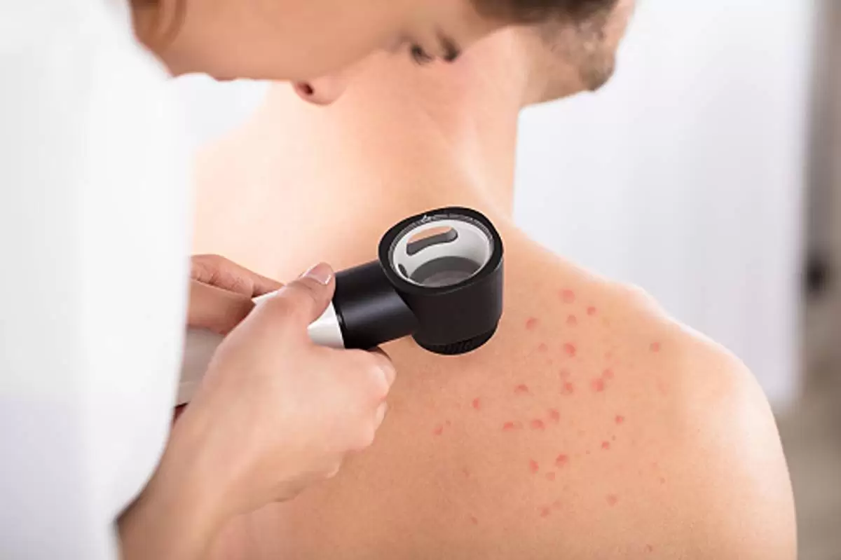 Pores and skin Cancer: Questions & Advice